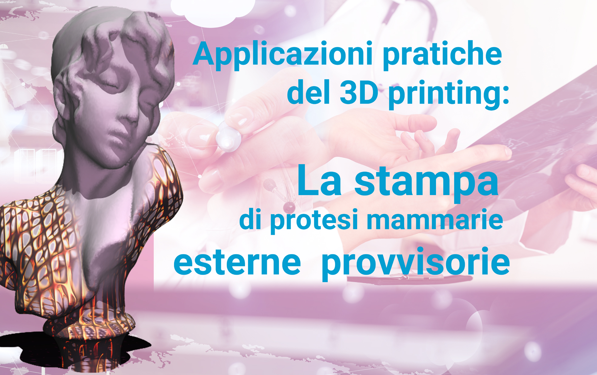 Applicazioni pratiche del 3D printing:La stampa di protesi esterne mammarie provvisorie